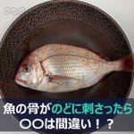 魚の骨やエビの尻尾を飲み込むと食道を貫通し大動脈に刺さったり腸管を破ることがある Togetter 魚の骨やエビの尻尾を飲み込むと食道を貫通し大動脈に刺さったり腸管を破ることがある Togetter