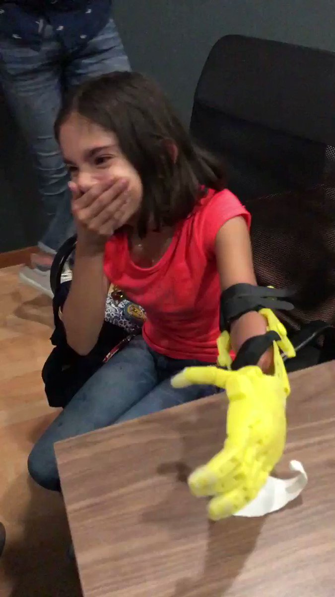 Amigos Twitteros, hace un año inicie un sueño - proyecto de hacer prótesis de bajo costo para niños. Hoy, gracias a los que creyeron en el proyecto, pusimos la primera.