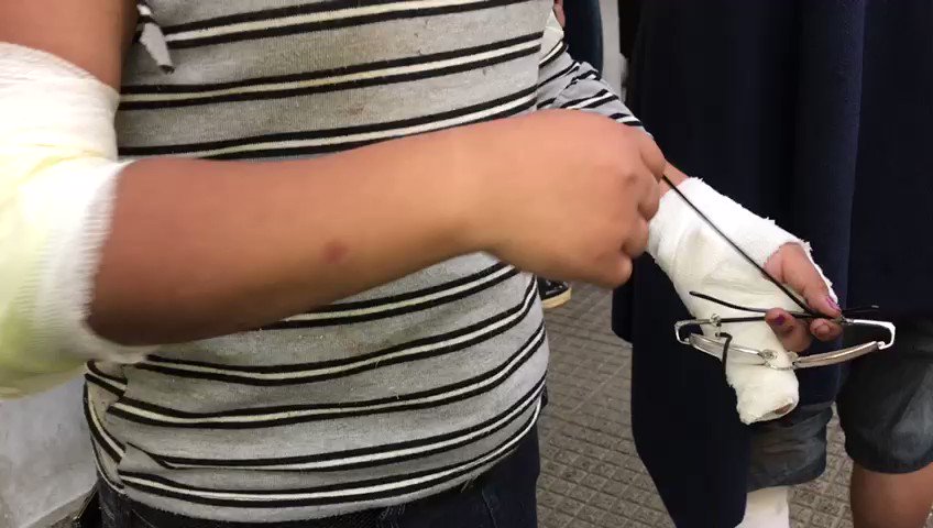 Video insertado