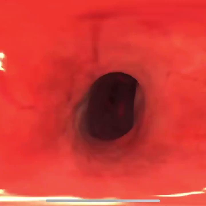 Sam Ghali, M.D. (@EM_RESUS) on Twitter photo 09/02/2020 17:59:20 Wow watch this incredible virtual tour inside the AMAZING human heart! #FOAMed Wow watch this incredible virtual tour inside the AMAZING human heart! #FOAMed