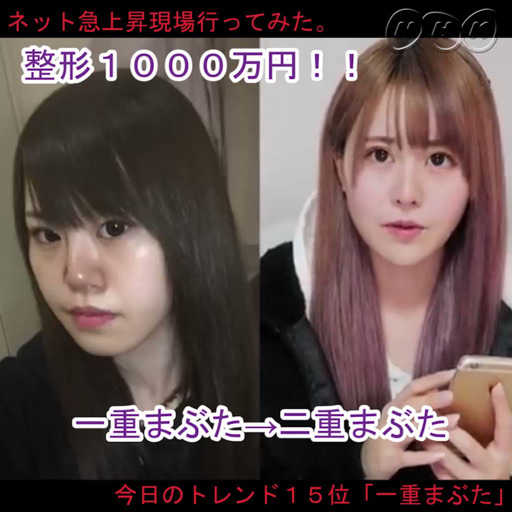 تويتر Nhkニュース على تويتر 一重まぶたの人でもかっこいい かわいい 人はたくさんいる 芸能人はみんな二重まぶたじゃないか など まぶたの形状と美醜についてのネットで激論が交わされている なぜ 一重 というだけで多くの人が苦しんでいるのか 整形