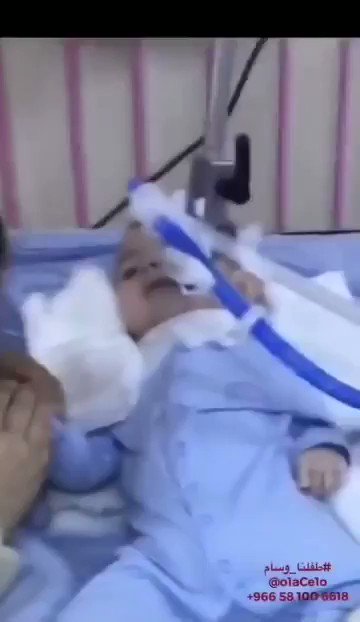 طفل بالمدينة المنوره مُصاب بضمور بالحبل الشوكي و أمه بين خيارين:
-يبقى في المستشفى طول عمره.
-تقرر فصل الاجهزه عنه ويموت.
لكن هناك دواء وتكلفته بما يقارب 2 مليون دولار ويطلبون الوقوف معهم والمسانده.
وهنا رقم التواصل من الفيديو:
0581006618
الله يشفيه ويعافيه
#طفلنا_وسام