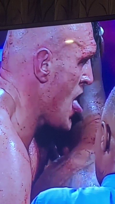You gotta retire after thisHow can a man fuck you up this badly then lick the blood off your neck like orochimaru