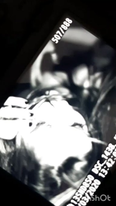 #photography #orgasm #face #blackandwhite #Professional #studioclip https://t.co/Ipdj7XjcKi