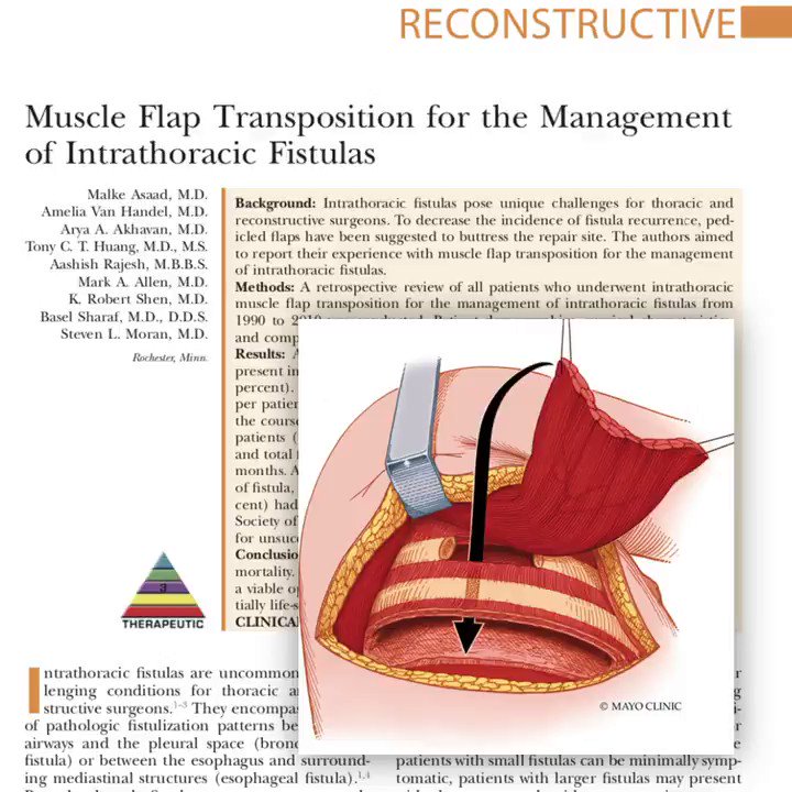 Plastic and Reconstructive Surgery on Twitter "In this PRSJournal