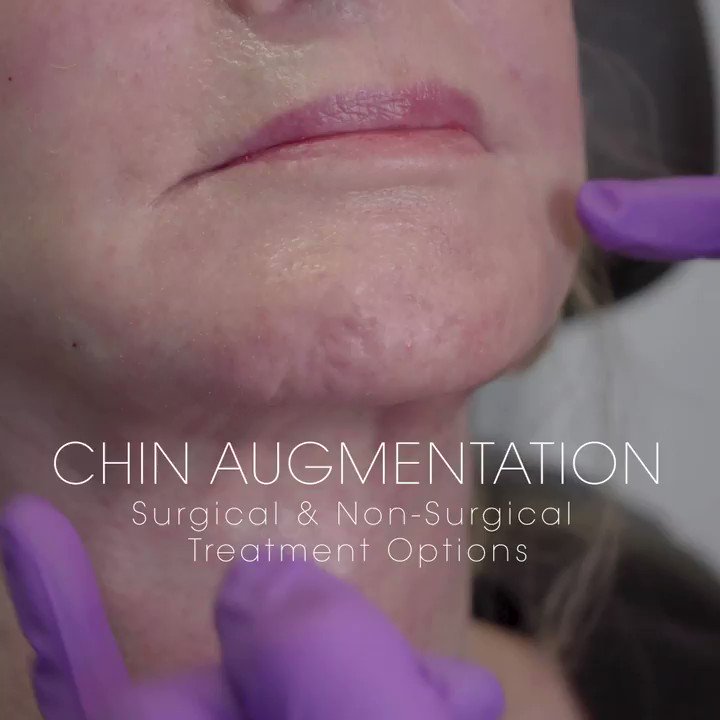 There are several ways to hydrate, contour and rejuvenate the appearance of a chin. When performing #chinaugmentation, I assess the patient’s concerns and anatomical features and discuss the different options that are available for them to achieve their aesthetic goals. https://t.co/8IUs67CaLP
