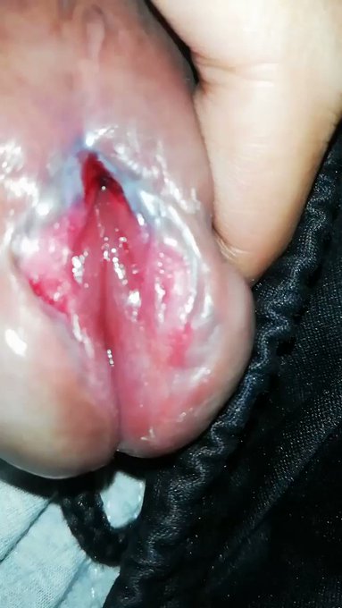 Mine.. What is yours?  #princealbertpiercing #papiercing #princealbert #piercing #piercedcock #PA #dick<a href="/tag/princealbertpiercing"class="tags">#princealbertpiercing</a><a href="/tag/papiercing"class="tags">#papiercing</a><a href="/tag/piercing"class="tags"><span>#piercing</span></a><a href="/tag/pa"class="tags"><span>#pa</span></a><a href="/tag/bigdick"class="tags"><span>#bigdick</span></a><a href="/tag/dick"class="tags"><span>#dick</span></a><a href="/tag/pierced"class="tags"><span>#pierced</span></a><a href="/tag/princealbert"class="tags"><span>#princealbert</span></a>