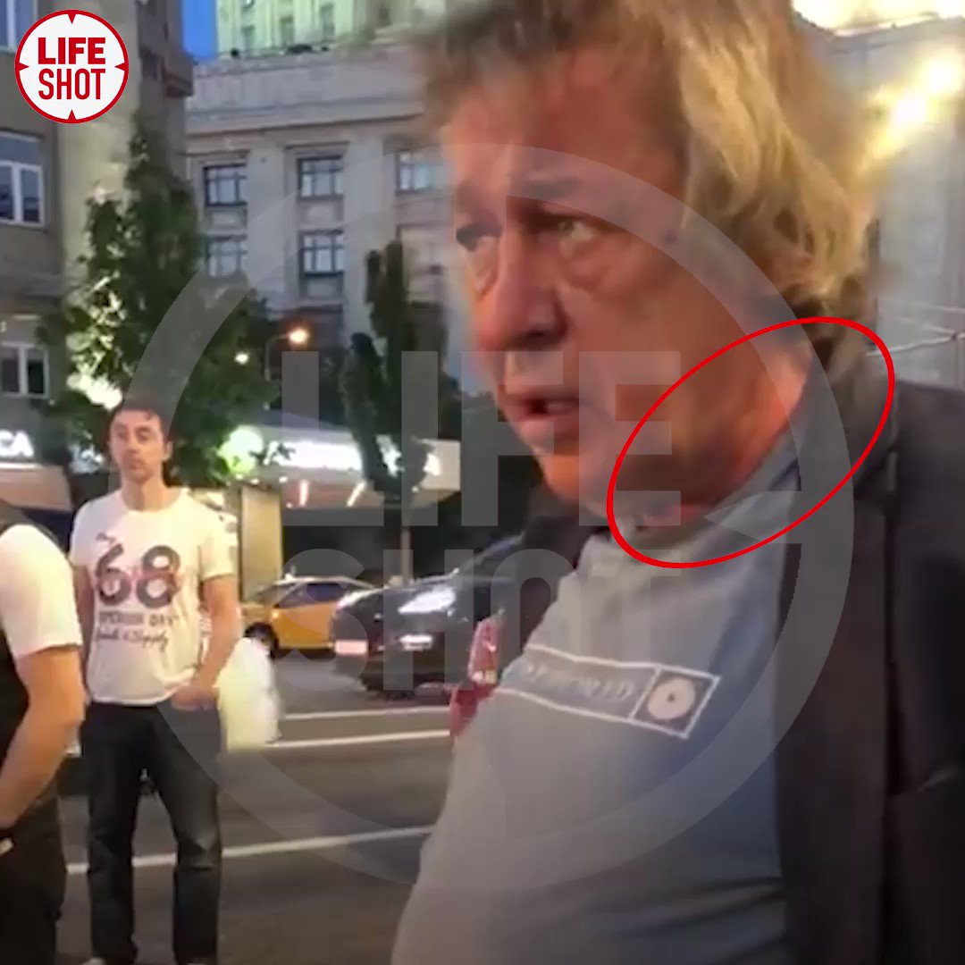 Шрамы от ремня безопасности
