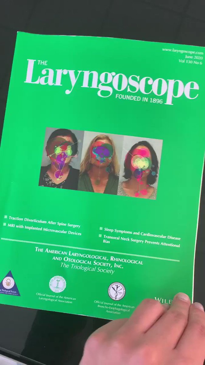 Dr. Spiegel continues to be at the forefront of research and writing.
“Scalp Advancement for Transgender Women: Closing the Gap” #Transgender #thespiegelcenter #FFS #Facialfeminization #surgery #surgeon https://t.co/oUZ1IGxB1M