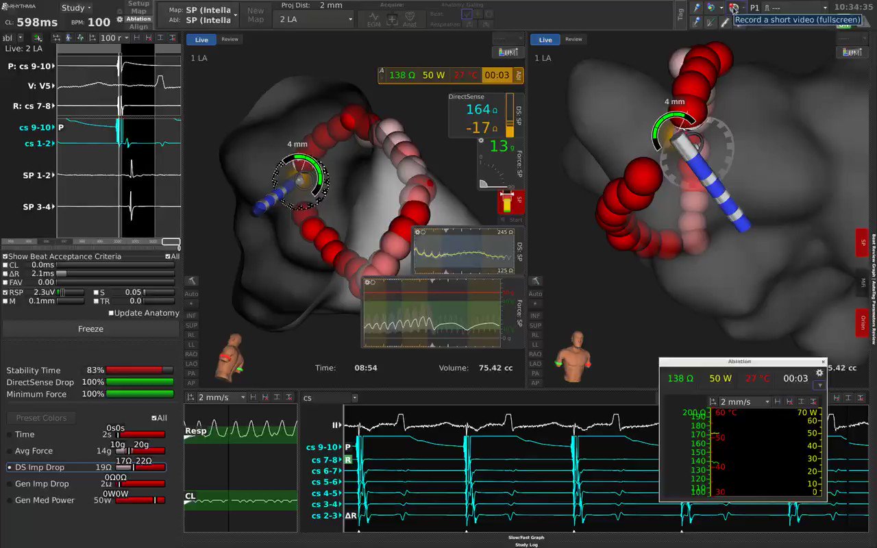 Prof Dhiraj Gupta On Twitter EPeeps The Much Awaited Contact Force 