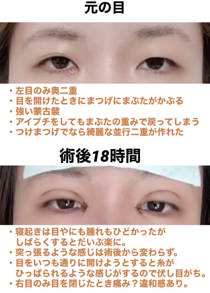 なつき度 術後18時間