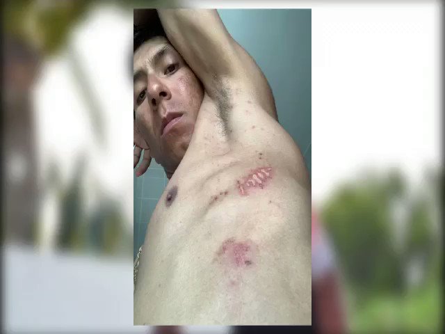 Este Tour me enseñó que a pesar de los duros golpes, no nos podemos rendir, que pedaleando con el corazón y la fuerza de todos los colombianos llegaré a París.
@LeTour @Arkea_Samsic https://t.co/RzMTlRN6ye