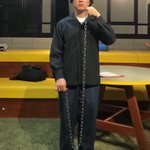 仕事中に鎖で遊んでいたら…鎖が当たってアゴが砕けた…
