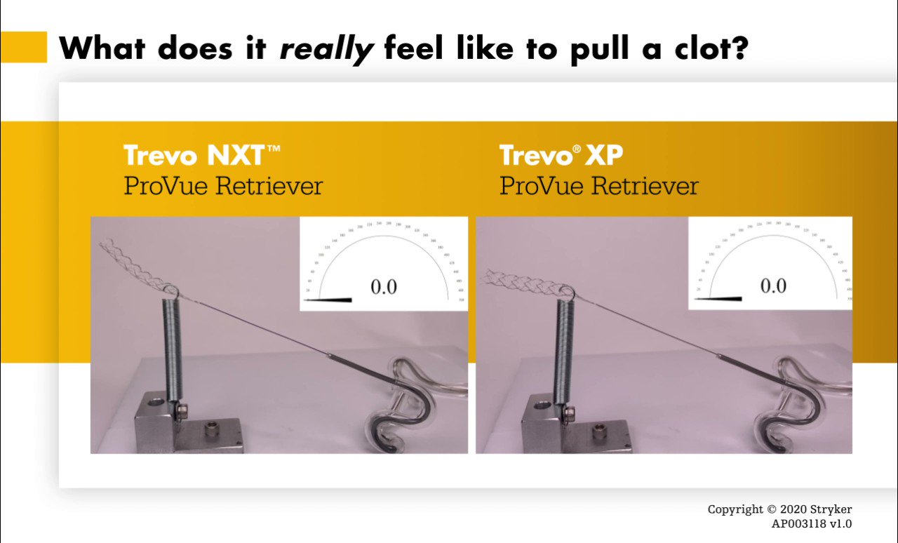 StrykerNeurovascular on Twitter "The combined use of stent retrievers