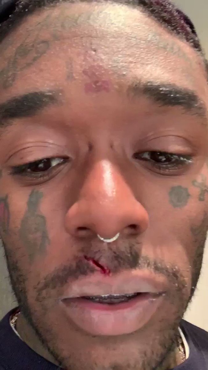 Uzi London ๐โ๏ธ๐ยฎ (@LILUZIVERT) on Twitter photo 2020-12-01 00:46:16 I need some chapstick ๐คฆ๐พโโ๏ธ๐๐ I need some chapstick ๐คฆ๐พโโ๏ธ๐๐