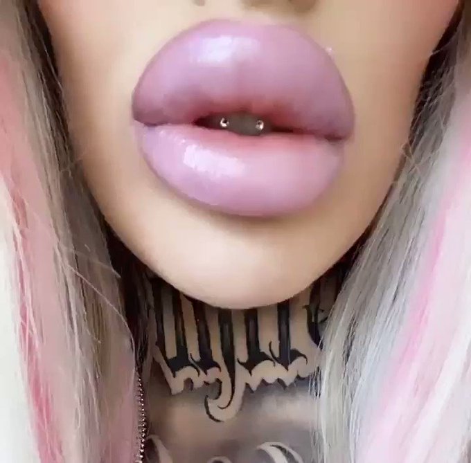 Freshly injected fuck doll ? I had 3ml in my lips yesterday omg I love it https://t.co/YTWcaXRYHO