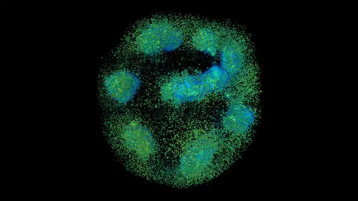 I got vaccinated a week ago.
By now, germinal centers were formed in my draining axillary lymph nodes located in the underarm area.
It should look like this (germinal centers in blue, emerging antibody-forming, and memory cells in green):
https://t.co/6ajL3ICB6n https://t.co/dfhUakcUSa