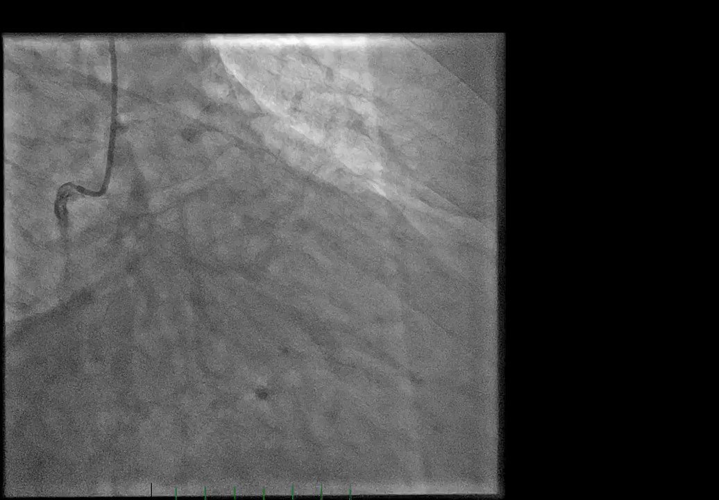 Proskomidija (proskomidija) / Twitter