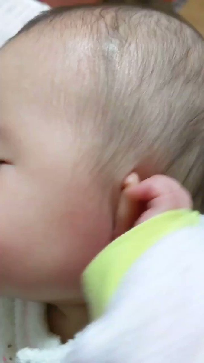 まりえ 40w1d 7m 眠い時に耳が痒くなる子結構多いみたいだね うちの子 耳切れもあるから何が原因なのかもはやよく分からん まりえ 40w1d 7m 眠い時に耳が痒くなる子結構多いみたいだね うちの子 耳切れもあるから何が原因なのかもはやよく分からん