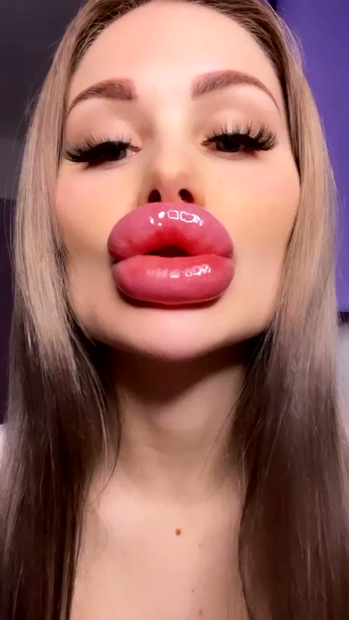 Tivvanni 💕 Onlyfans on Twitter: "Join my VIP Page for the best Lip Fetish  Clips. 💋👄 &amp; dm me for the special long videos. 🍌🍭🍬🍪 #lips  #lipfetish #lippenfetisch #biggestlips #bimboification #plasticsurgery  #lipcontent #