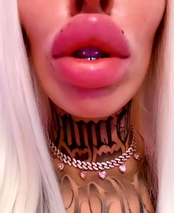 FRESHLY injected dick sucker lips - we fit 3cc more in them ? 
Join https://t.co/GpL6SWl3ay for more