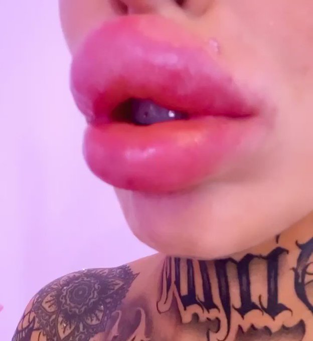 Freshly injected dick sucker lips ?? we added 2ml more to my lips today ???
For more subscribe to my
