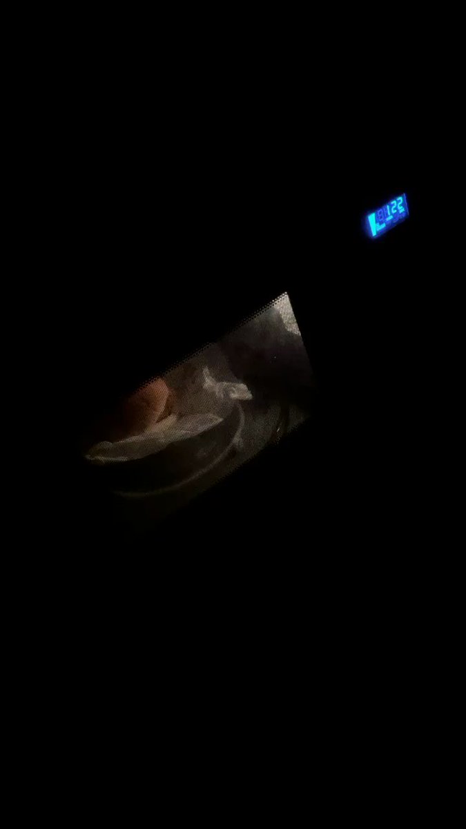ps: I got a microwave ☺️
I’m glad common sense prevailed at this hotel. Take notes Auckland quarantine. https://t.co/4qmPy5egxt