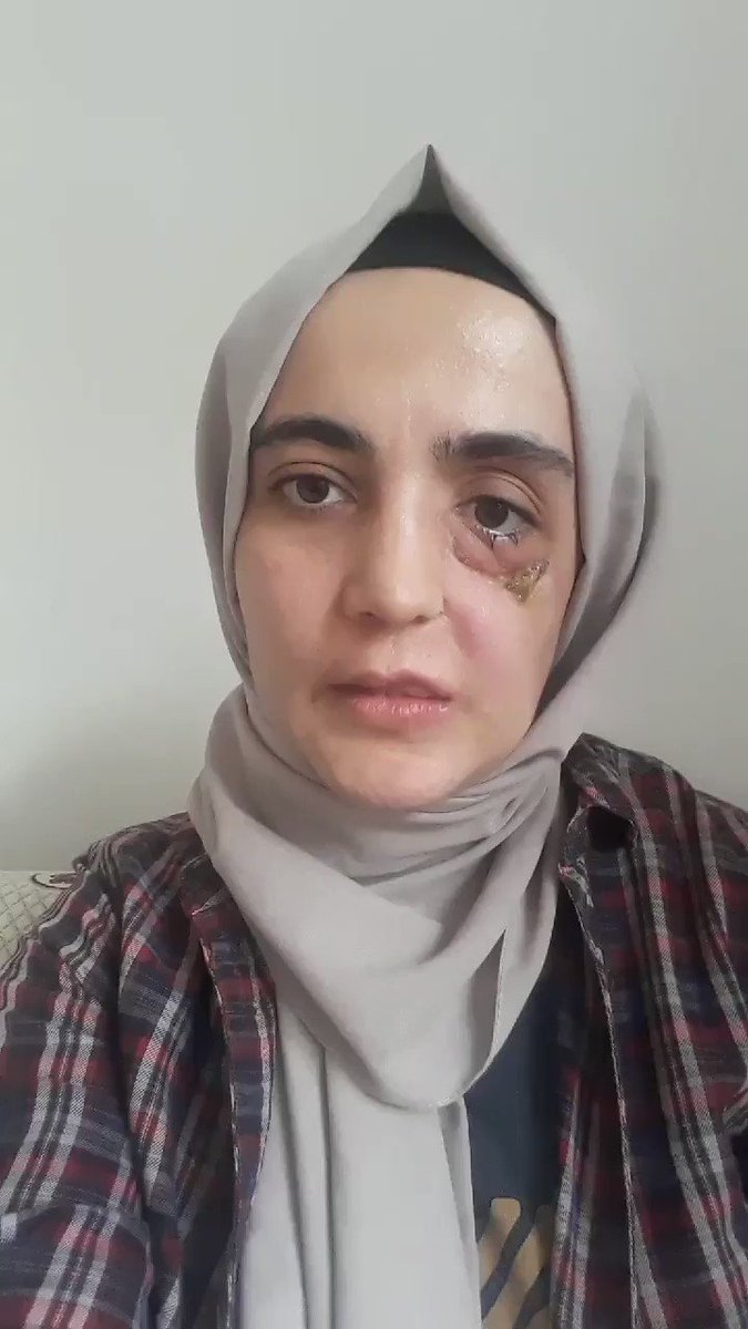 Ömer Aktaş (@merAkta10300986) | Twitter