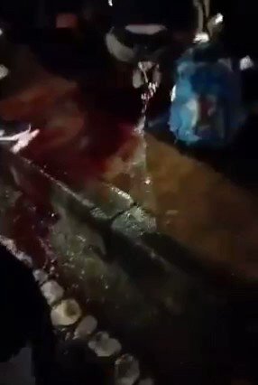 Aquí les informamos. Lamentablemente se confirma la muerte del joven el cual fue impactado con un objeto en su cabeza en la localidad de suba en Bogota, al parecer no pudo aguantar la pérdida de sangre y falleció ,lamentamos su pérdida.
Fuente :Resistencia
#ParoNacional23J https://t.co/CavCLvnh8G