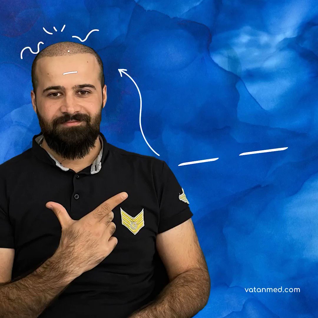 Vatanmed Hairtransplant Vatanmedsacekim Twitter