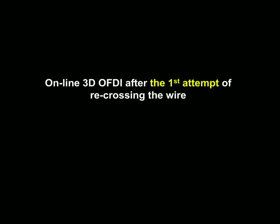 Online three-dimensional optical frequency domain imaging (3D-OFDI) could help operators to undertake rewiring of the optimal cell, resulting in a lower rate of malapposition compared with angiography-guided PCI. #EIJBestOf https://t.co/L2eK1FlqeK https://t.co/2pDLIpKvHf