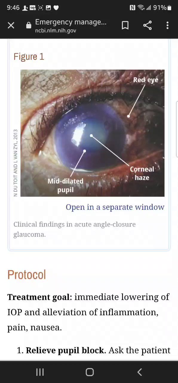on Twitter "srrezaie If AACG The patient may complain of a painful red eye, headache