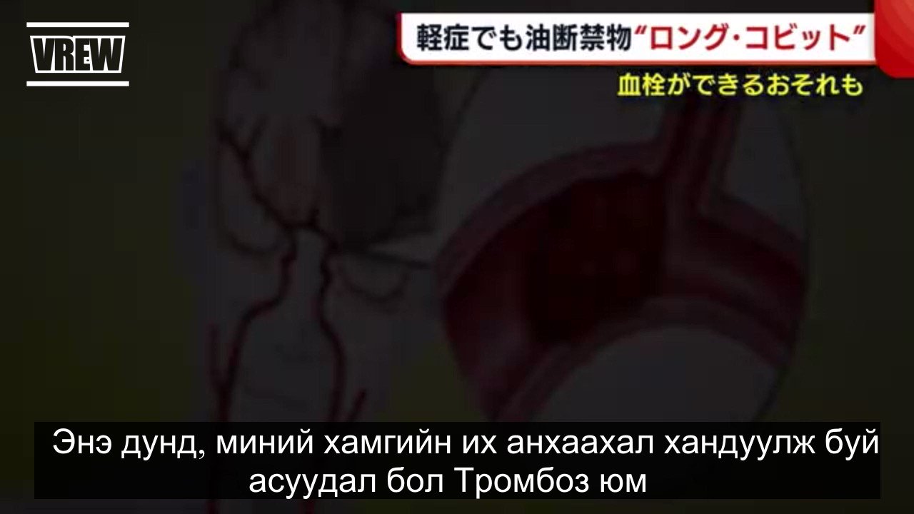 Баттулга ГАНХУЯГ (@gankhuyag_mng) / Twitter