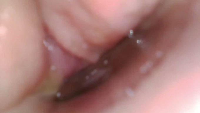 Just made another sale! endoscope up my butt https://t.co/E6pFNie5vL #MVSales https://t.co/IyhwtrvDJ<a href="/tag/mvsales"class="tags"><span>#mvsales</span></a>