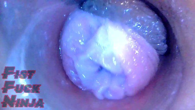 Just made another sale! Haruka Endoscope view https://t.co/14go1XwueR #MVSales https://t.co/aA3ti8XY<a href="/tag/mvsales"class="tags"><span>#mvsales</span></a>