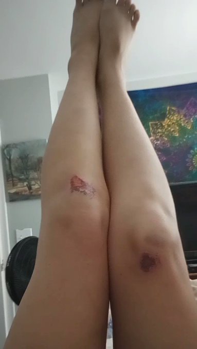 Can you guess how this happened? 🥲🤭 #nsfwtwt #feetfinder #hardcore #pain #thot #onlyfans #daddyslittleslut<a href="/tag/nsfwtwt"class="tags">#nsfwtwt</a><a href="/tag/feetfinder"class="tags">#feetfinder</a><a href="/tag/thot"class="tags"><span>#thot</span></a><a href="/tag/hardcore"class="tags"><span>#hardcore</span></a><a href="/tag/pain"class="tags"><span>#pain</span></a><a href="/tag/daddyslittleslut"class="tags"><span>#daddyslittleslut</span></a><a href="/tag/only"class="tags"><span>#only</span></a>
