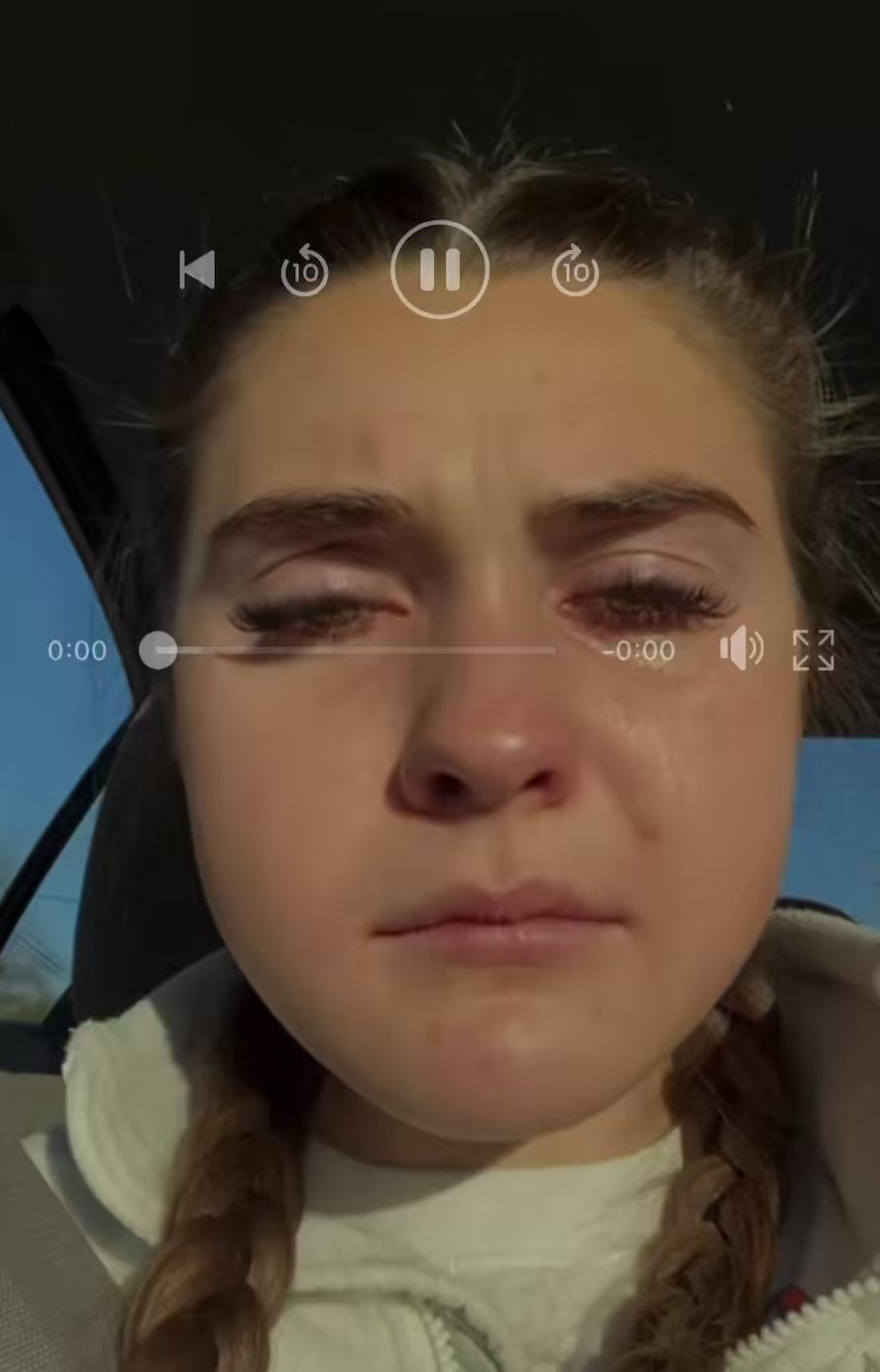 Bengal Jim s BTR On Twitter The Best Wisdom Tooth Video Ever I Know bengal-jim-s-btr-on-twitter-the-best-wisdom-tooth-video-ever-i-know