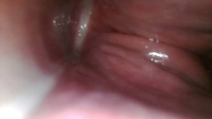 Thank you for buying! endoscope up my butt https://t.co/iQPFuXWzJu #MVSales https://t.co/aHVm580hB1<a href="/tag/mvsales"class="tags"><span>#mvsales</span></a>