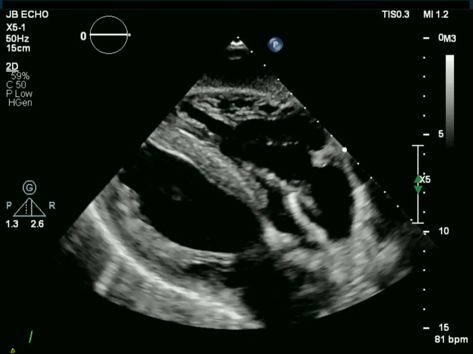 European Society of Cardiology Journals on Twitter "A case of