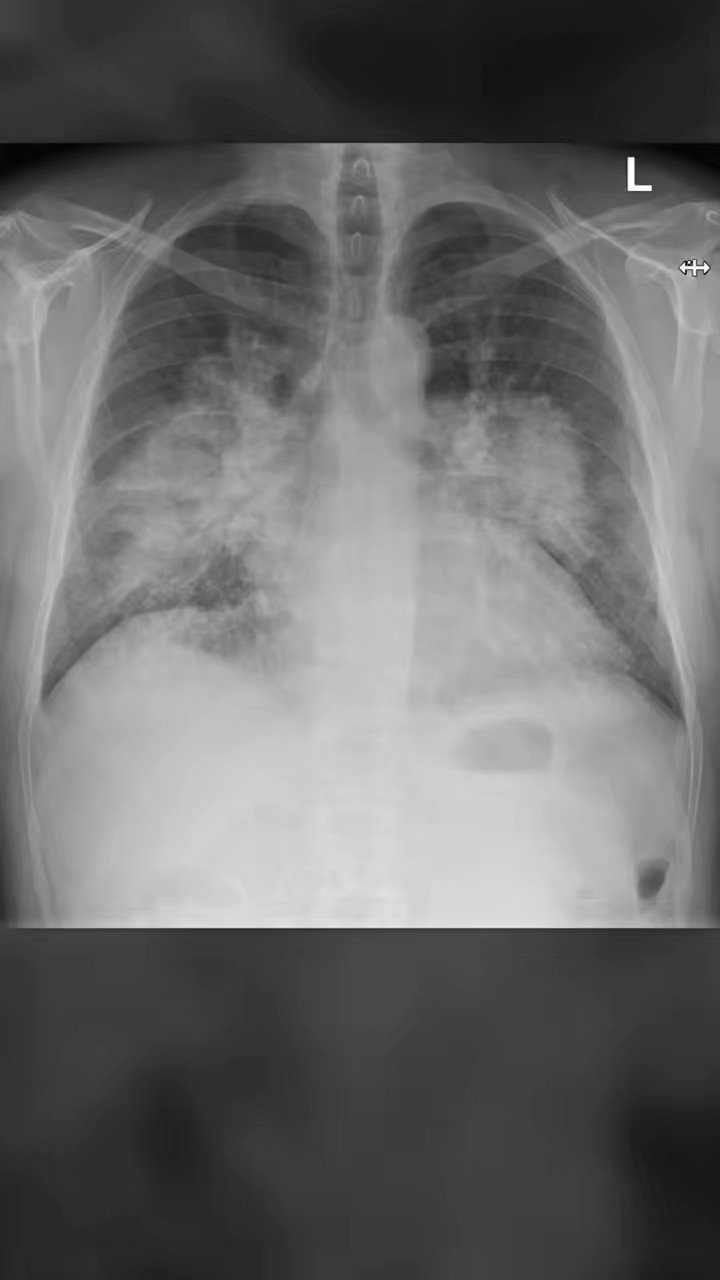 theRadiologist on Twitter "A male in his 40s presents to the Emergency