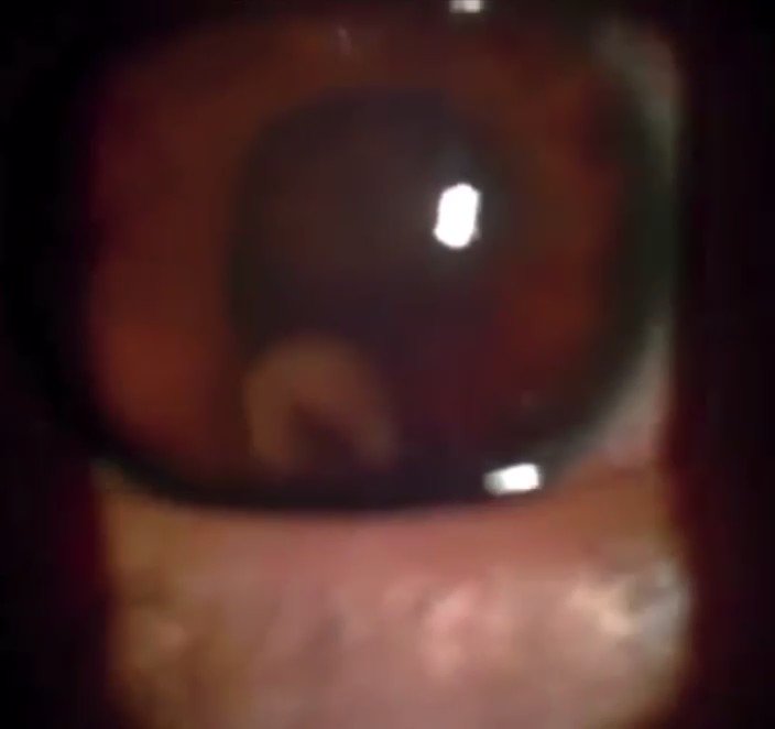 oren-gottfried-md-on-twitter-17-yo-presented-with-3-weeks-history-of