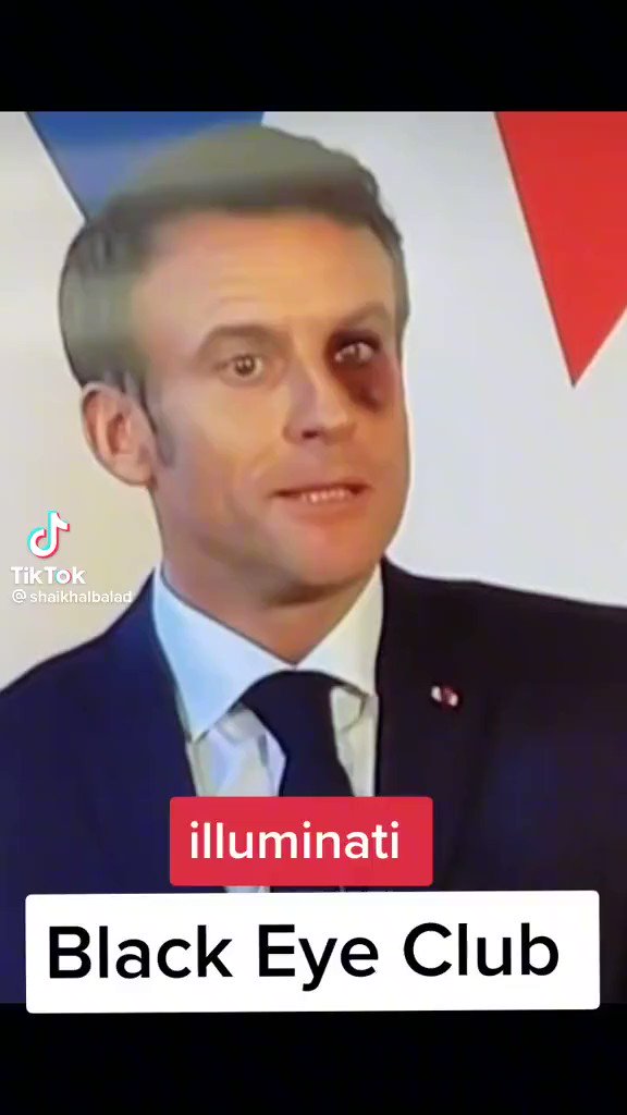 vegastar on Twitter "The "Black Eye" Club an unofficial collective of politicians 🏛️