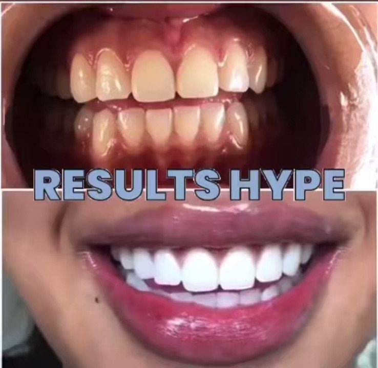 Dima LushBeauty on Twitter "Please retweet 😊 Not only does AP️ 24