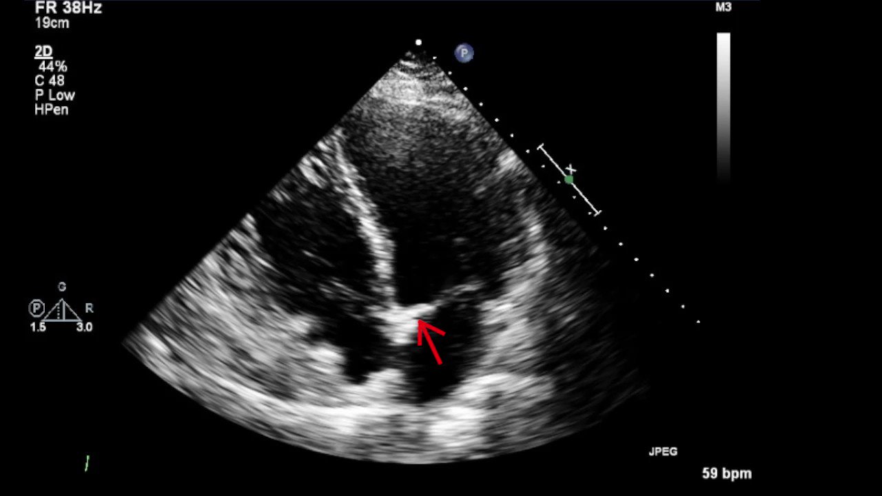 American Society of Echocardiography on Twitter