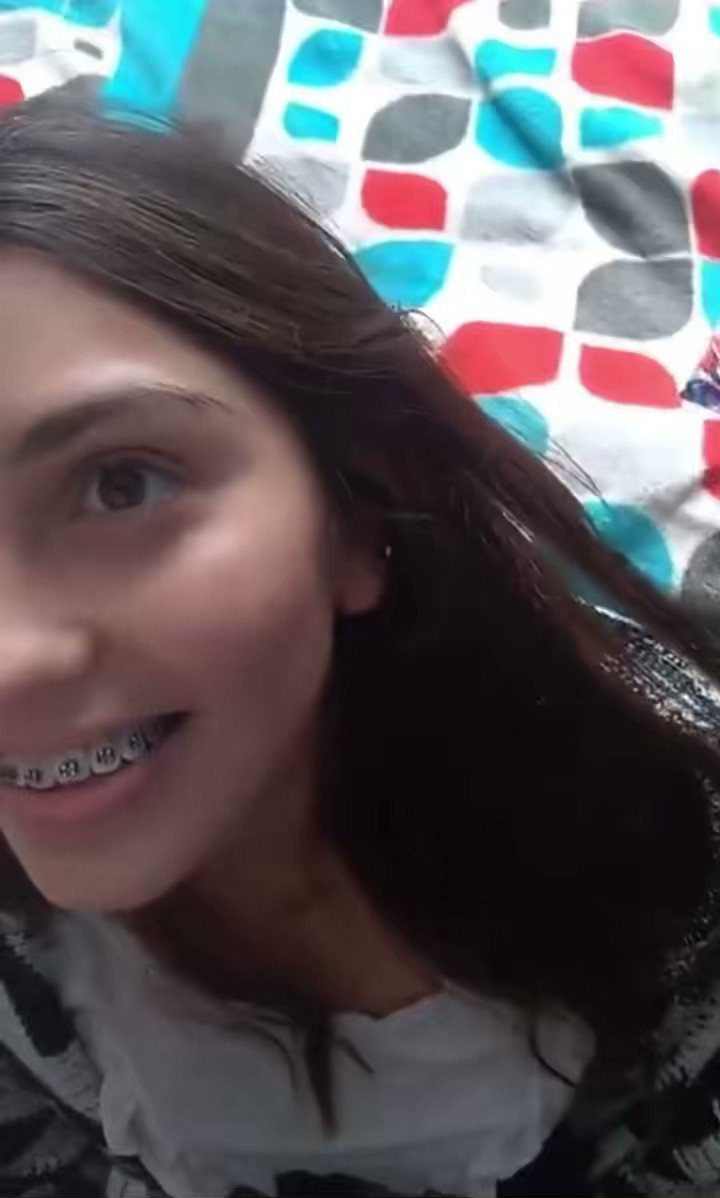 Braces girl twitter video