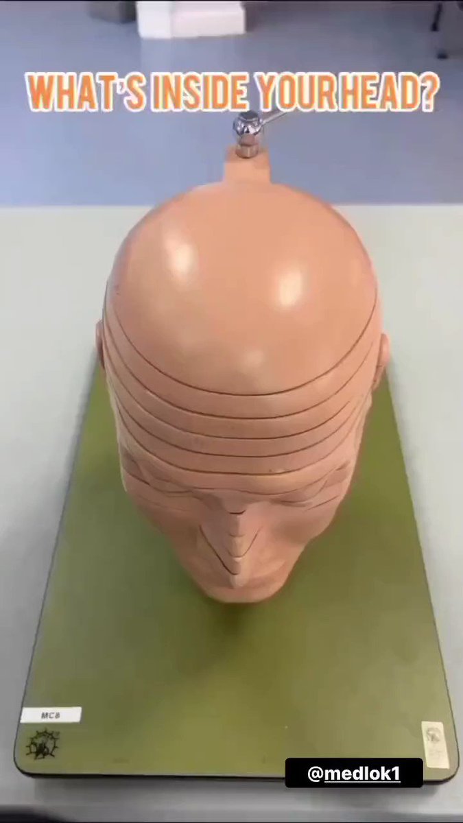 解剖女尸    