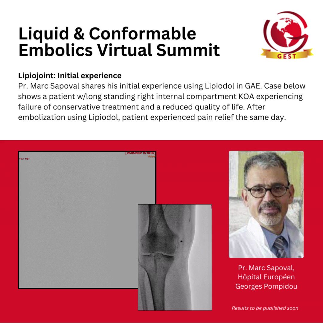 GEST Global Embolization Symposium & Technologies on Twitter "Dr