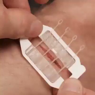 RT @isciverse: Emergency Laceration Closures
#MedTwitter #technology
https://t.co/iNipc0d6vF