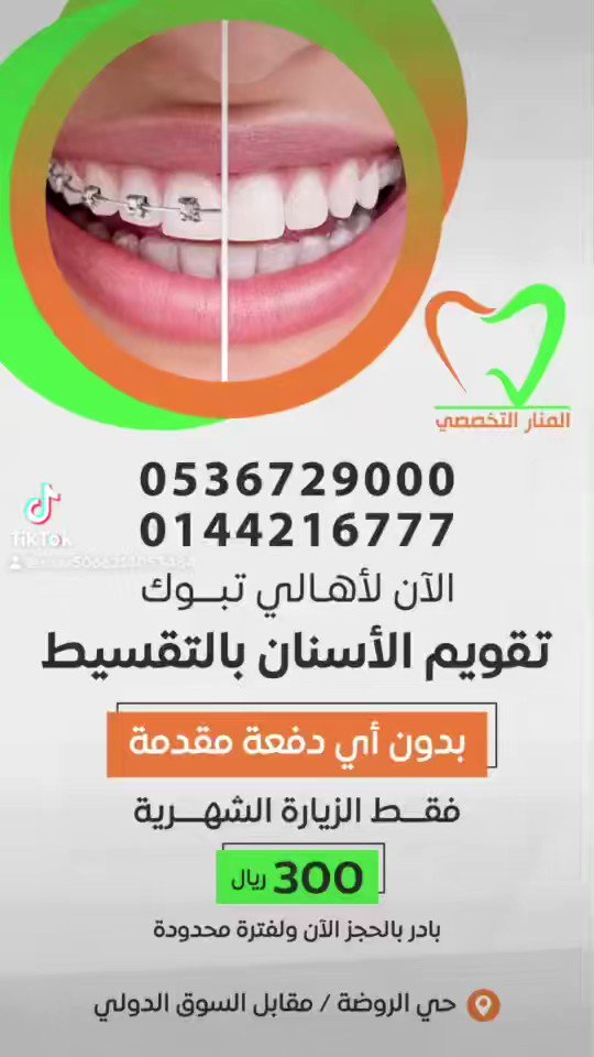 افضل مستوصف اسنان بتبوك - دليلك الشامل