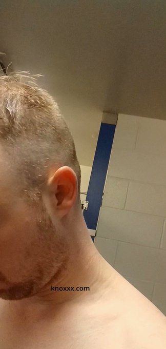 protect your feet and wear shoes in public gyms #FootProtection #FootFungus #AthletesFoot #PublicWashrooms<a href="/tag/public"class="tags"><span>#public</span></a><a href="/tag/barefeet"class="tags"><span>#barefeet</span></a><a href="/tag/healthtip"class="tags"><span>#healthtip</span></a><a href="/tag/footfungus"class="tags"><span>#footfungus</span></a><a href="/tag/athletesfoot"class="tags"><span>#athletesfoot</span></a>